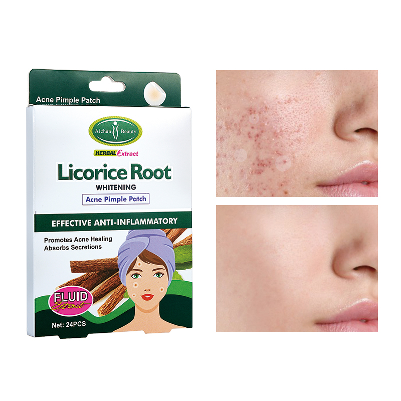 [AICHUN BEAUTY] Патчи для лица против акне ЭКСТРАКТ КОРНЯ СОЛОДКИ Licorice Root Acne, 24 шт